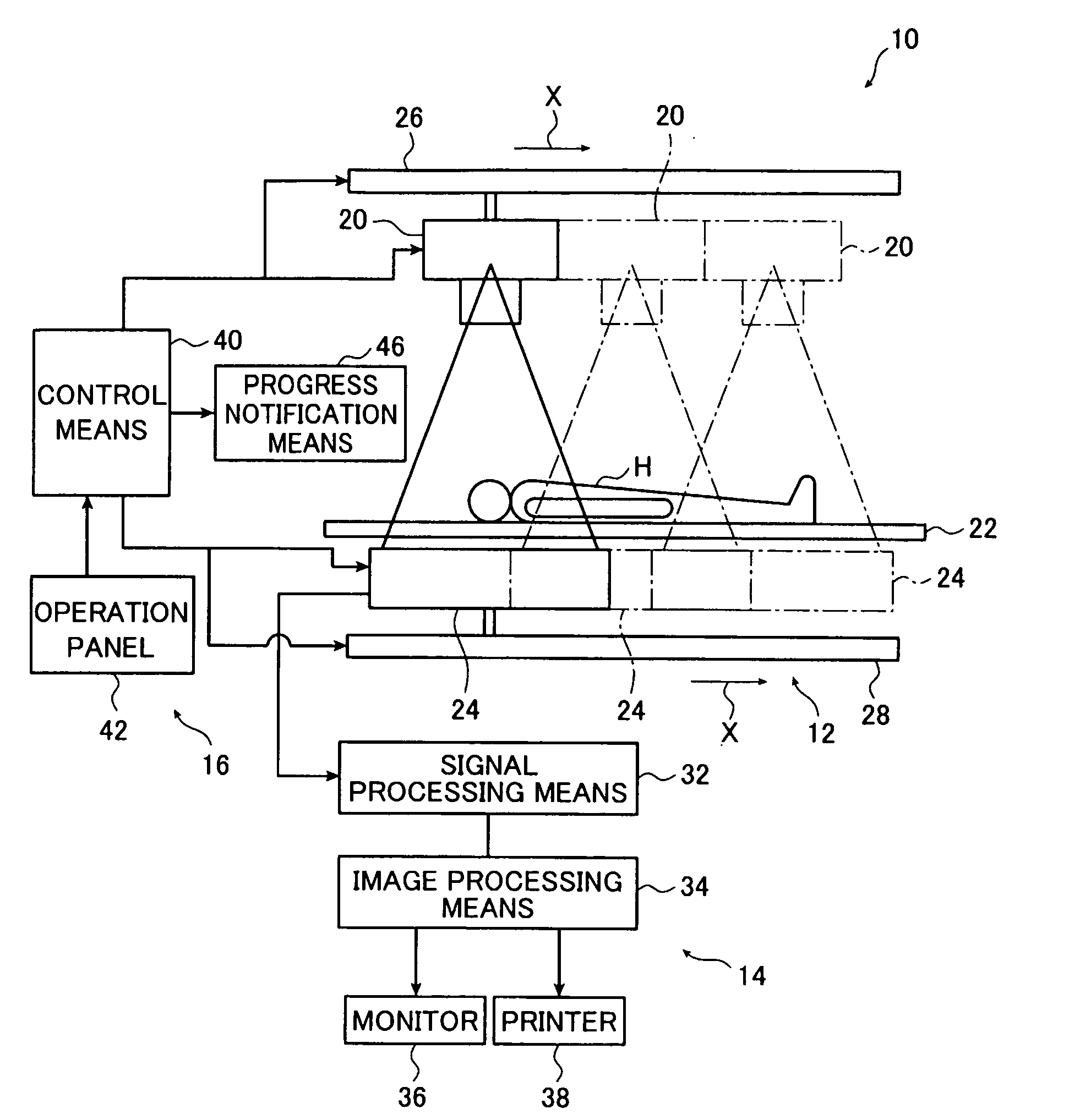 Radiographic imaging system