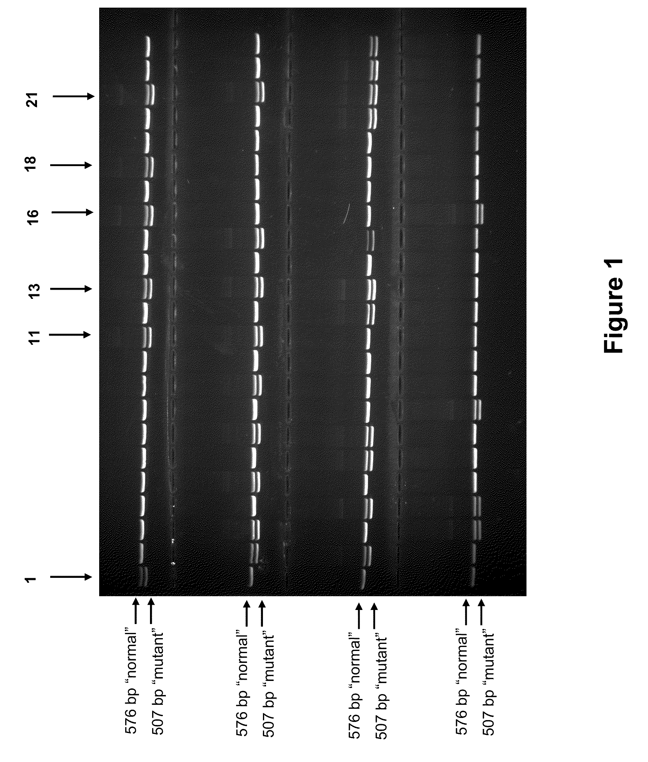 Screening for Arthrogryposis Multiplex in Bovines