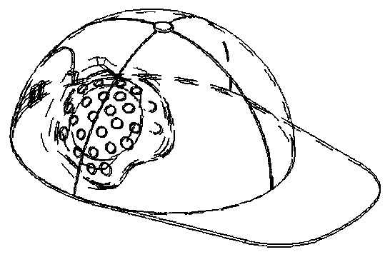 Personalized skull defect protection device and preparation method