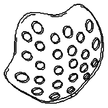 Personalized skull defect protection device and preparation method