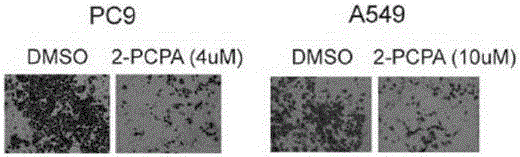 Application of KDM1A micro-molecular inhibitor in inhibition of growth and transfer of tumor cells