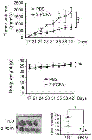 Application of KDM1A micro-molecular inhibitor in inhibition of growth and transfer of tumor cells