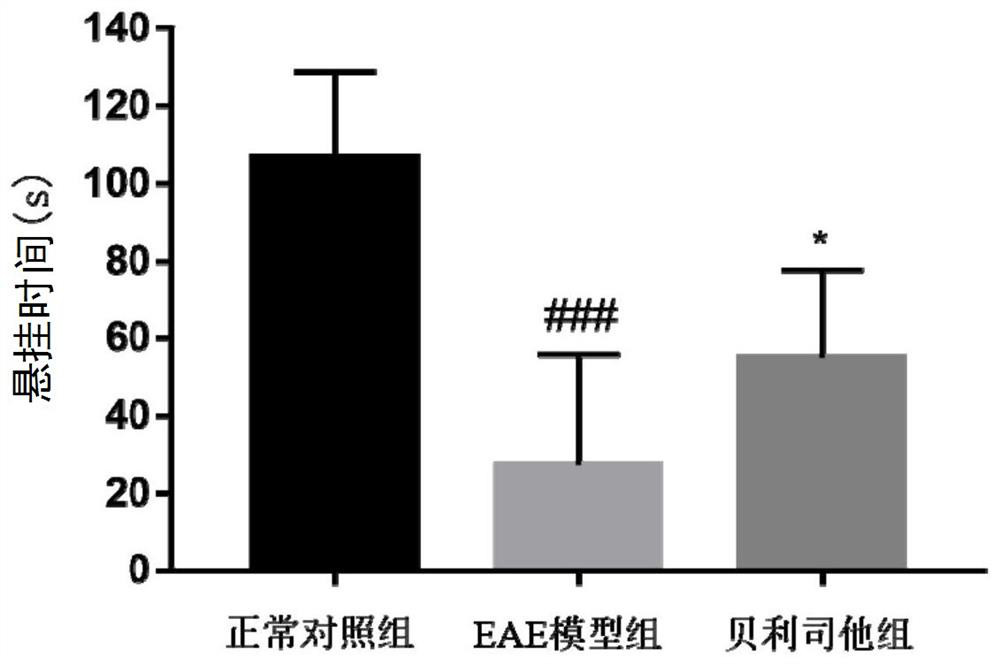 Application of belinostat in preparation of medicine for preventing, relieving and/or treating multiple sclerosis