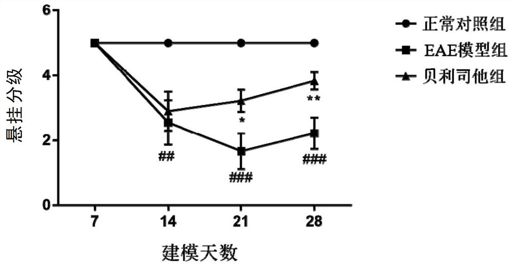 Application of belinostat in preparation of medicine for preventing, relieving and/or treating multiple sclerosis