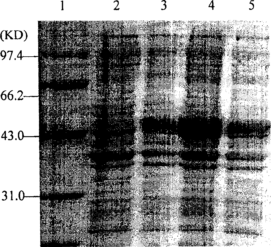 Recombined diphtheria toxin, preparation method, and application