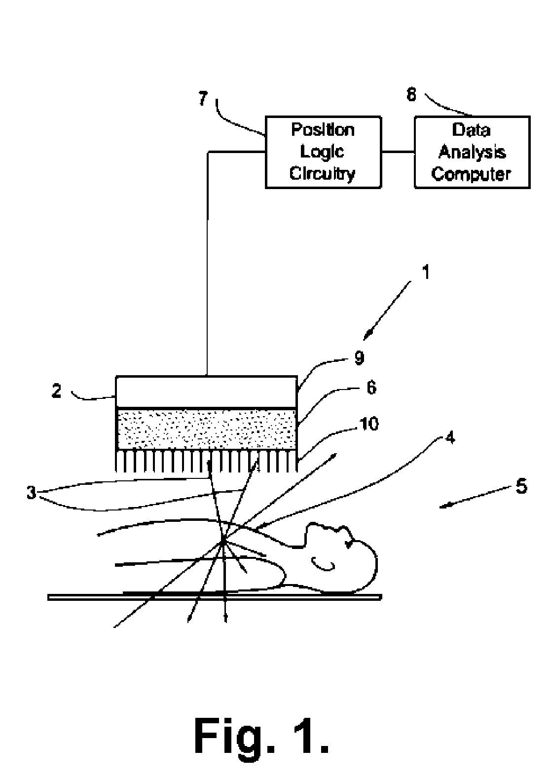 SPECT gamma camera with a fixed detector radius of orbit