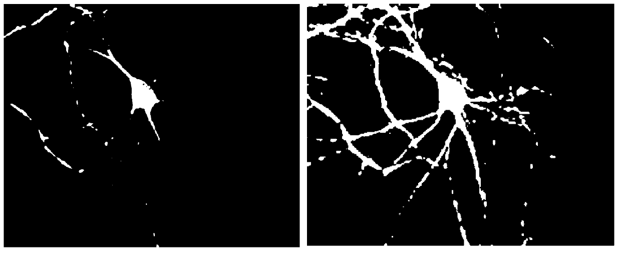 Nerve dendritic spine image classification method based on multiresolution fractal features