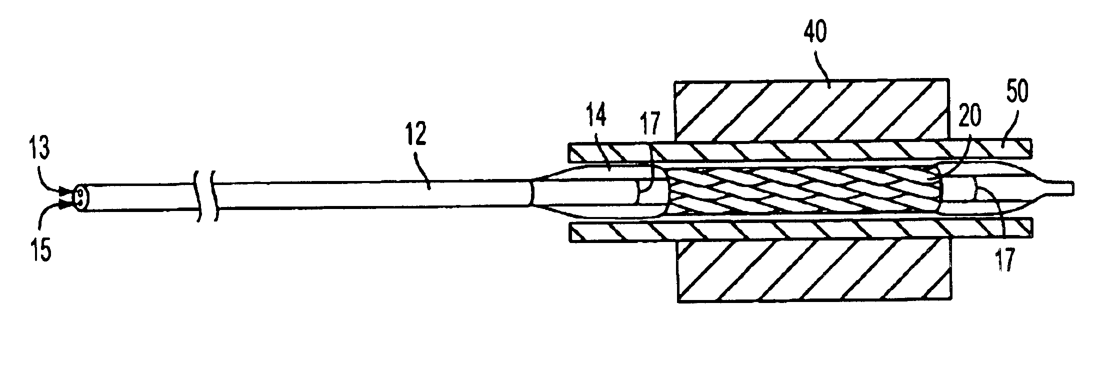 Cold-molding process for loading a stent onto a stent delivery system