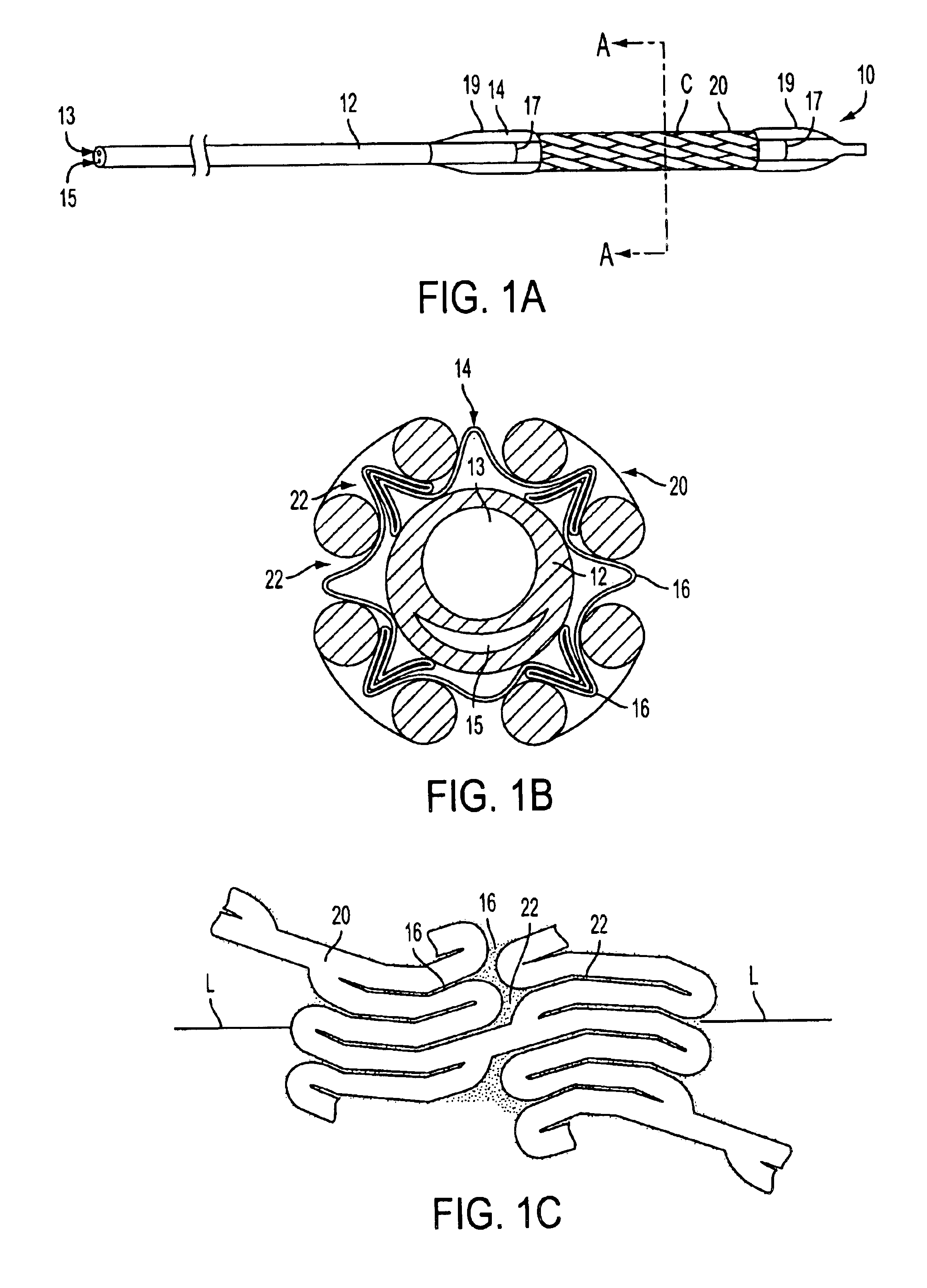 Cold-molding process for loading a stent onto a stent delivery system