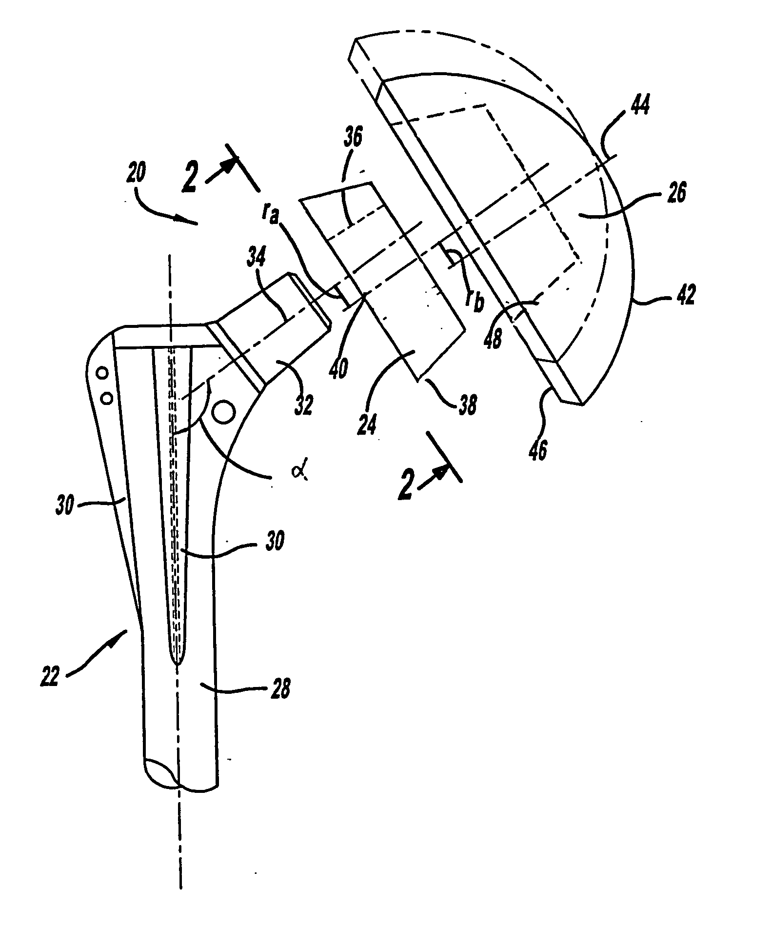 Shoulder prosthesis