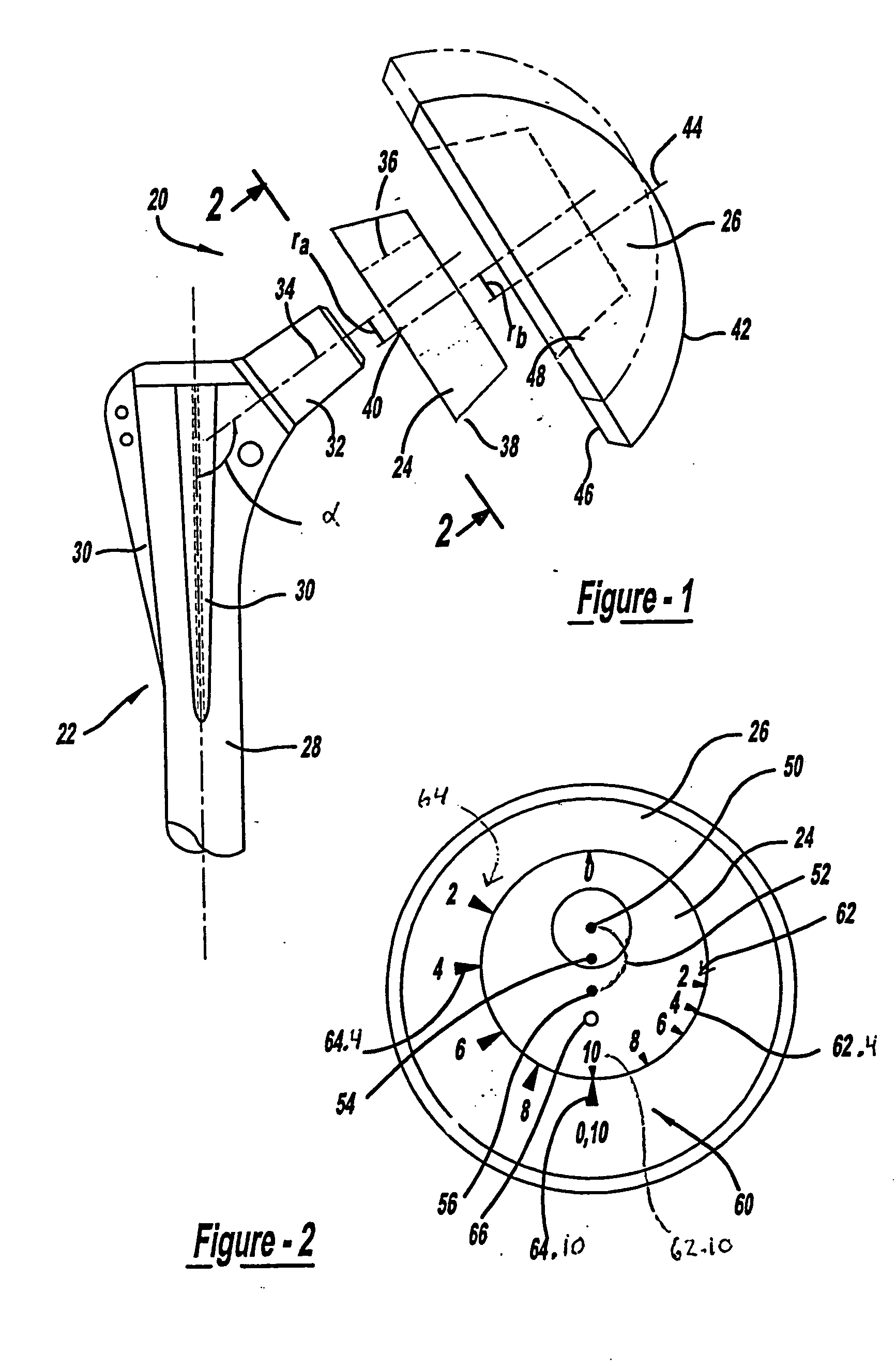 Shoulder prosthesis