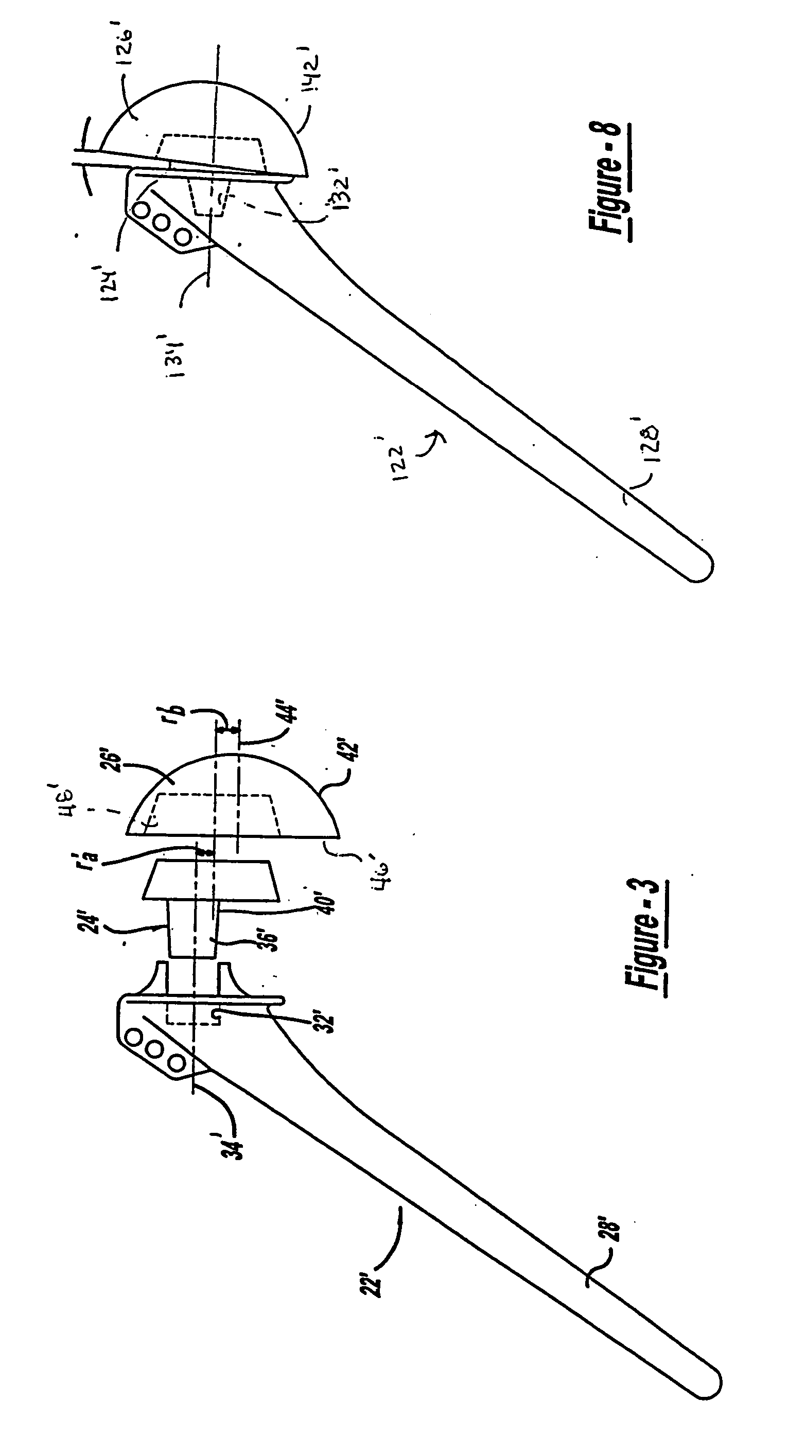 Shoulder prosthesis