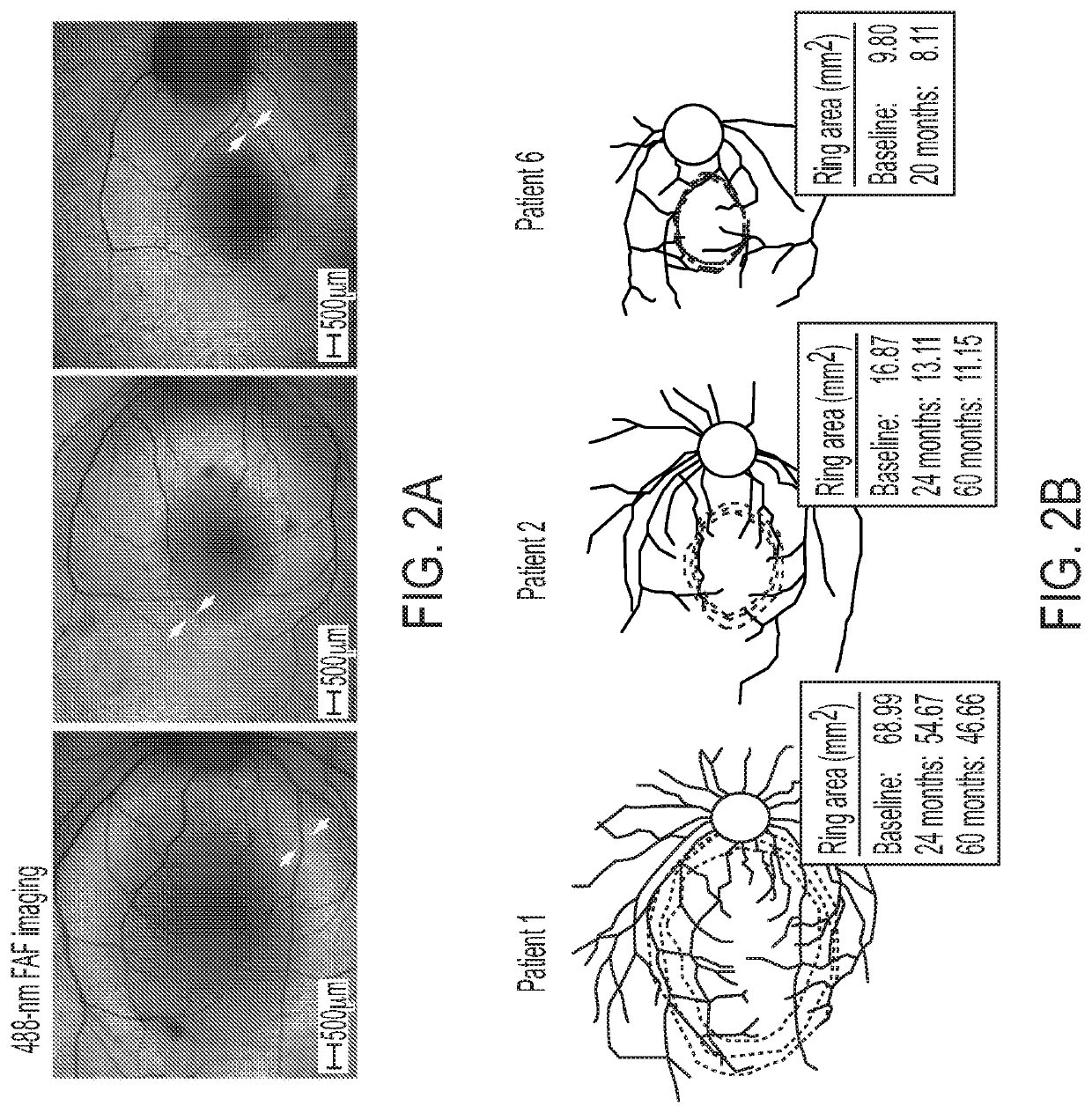 Enhanced human opsin promoter for rod specific expression