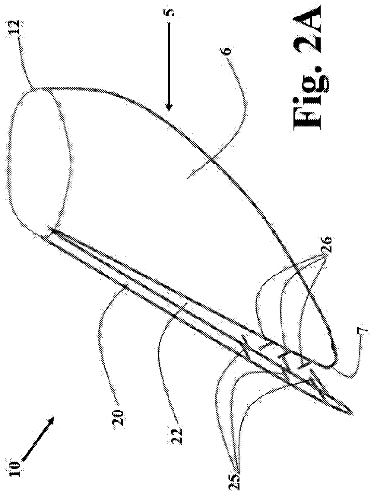 Transcatheter artificial cusp for valve insufficiency