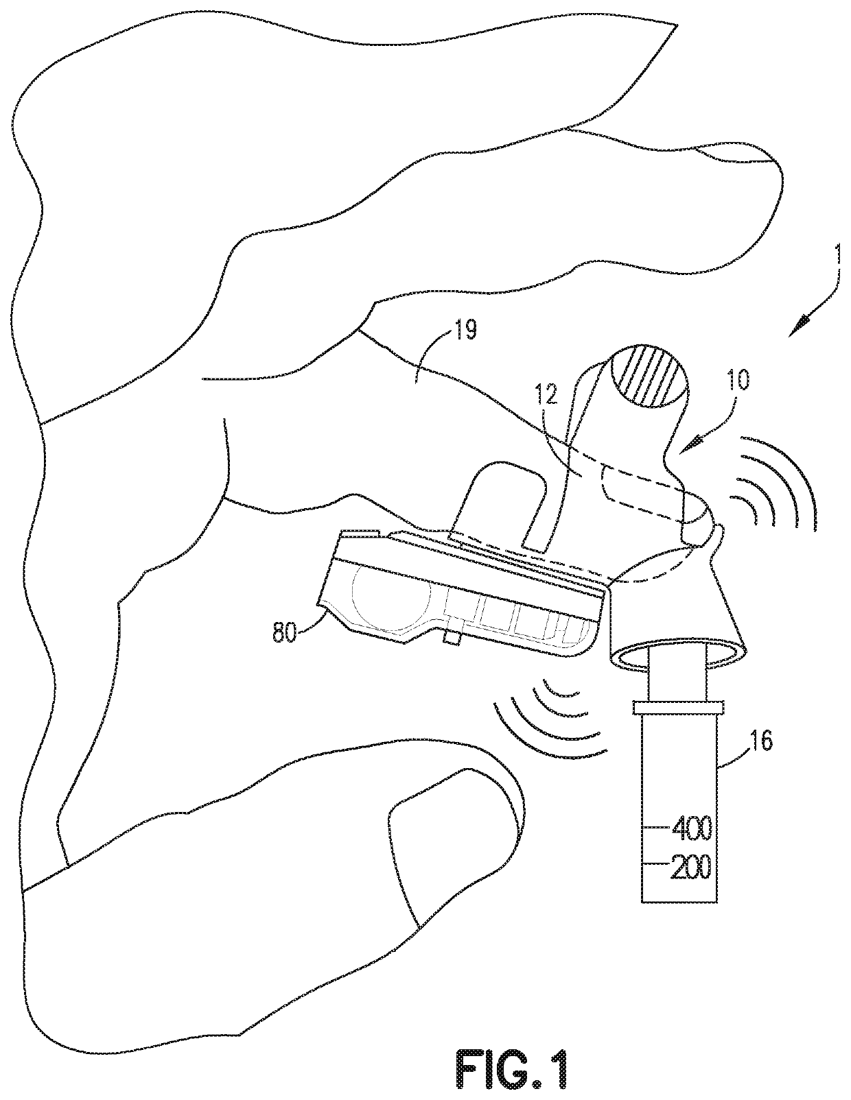 Blood Collection Assembly with Vibration Module