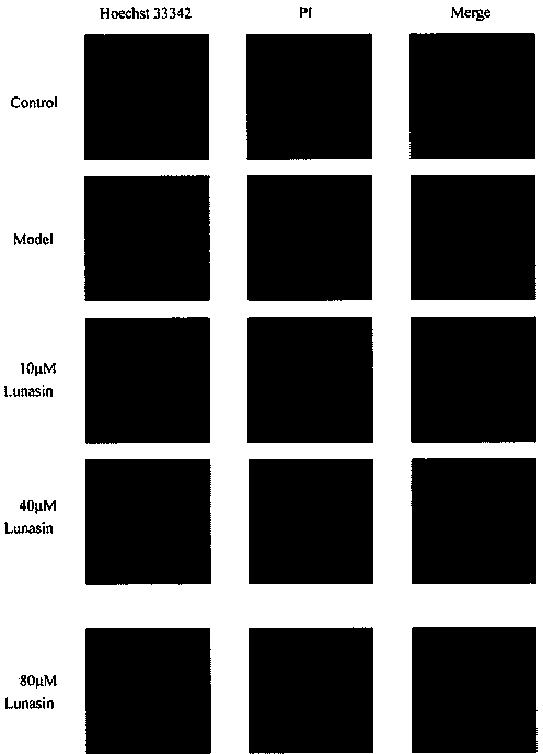 Application of lunasin polypeptide in medicine for preventing and treating cataract