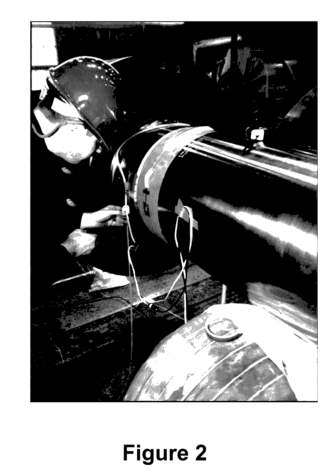 Apparatus and Methods for Direct Sensing of Rotational Dynamics of a Rotating Shaft