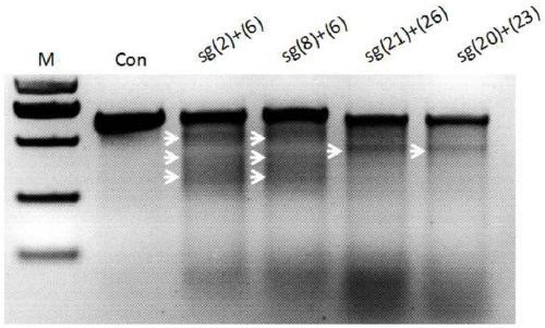 SgRNA, expression vector and kit used for targeted knockout of human NKG2A/KLRC1 gene and application of sgRNA used for targeted knockout of human NKG2A/KLRC1 gene