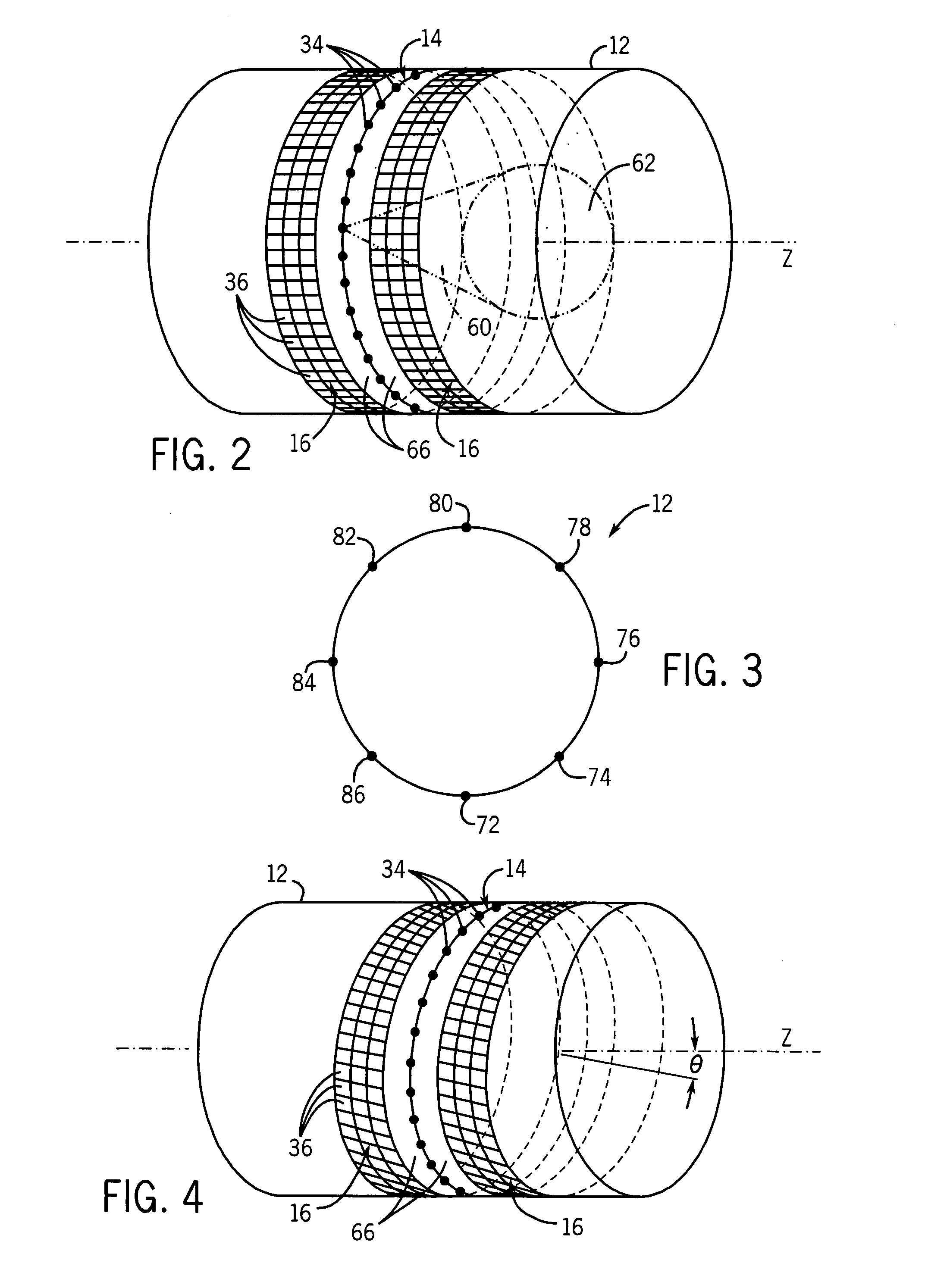 Acquisition and reconstruction of projection data using a stationary CT geometry