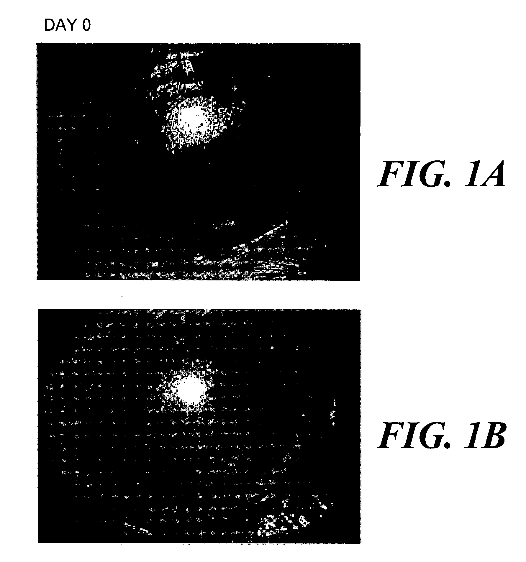 Use of a human amniotic membrane composition for prophylaxis and treatment of diseases and conditions of the eye and skin