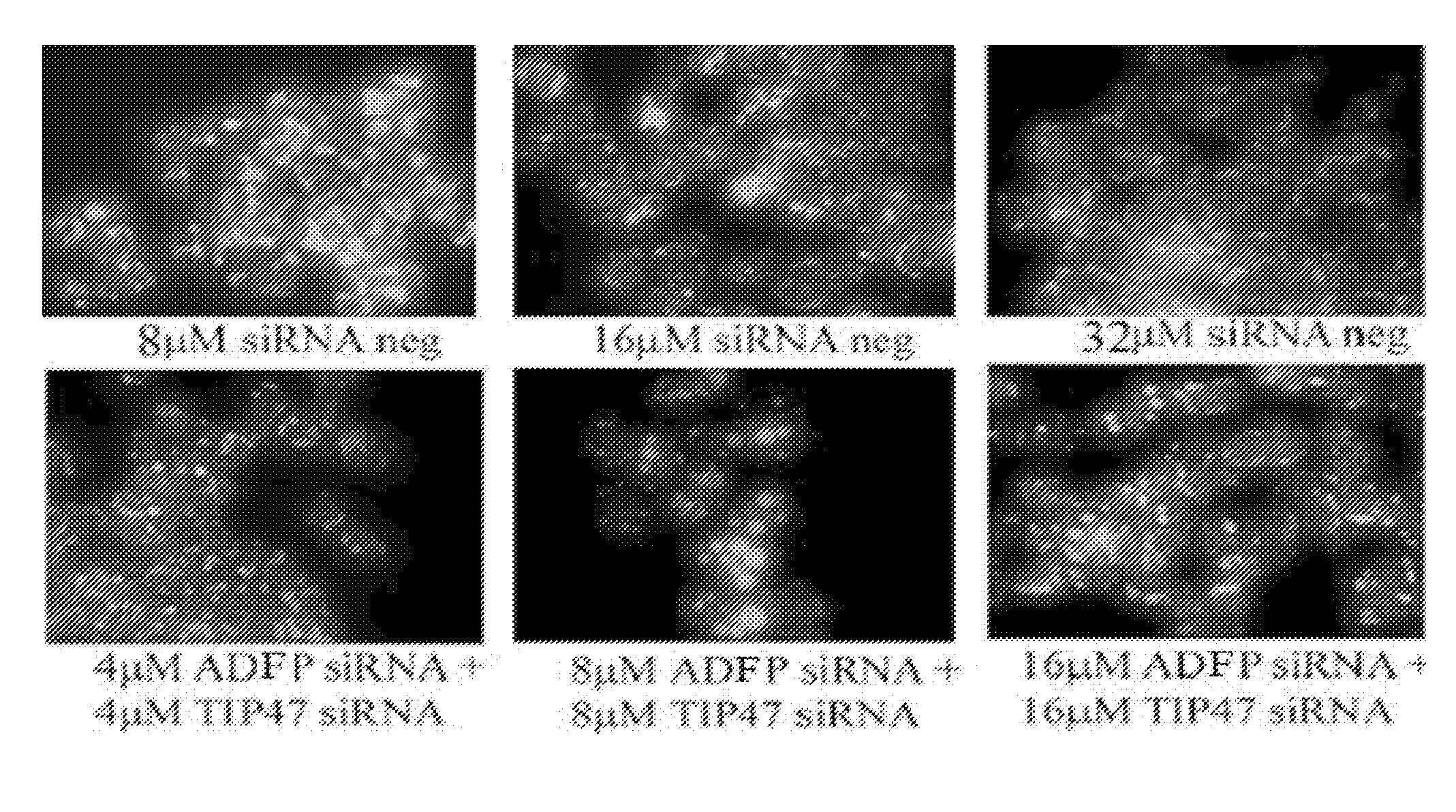 Method of measuring lipid droplets and applications of using the same