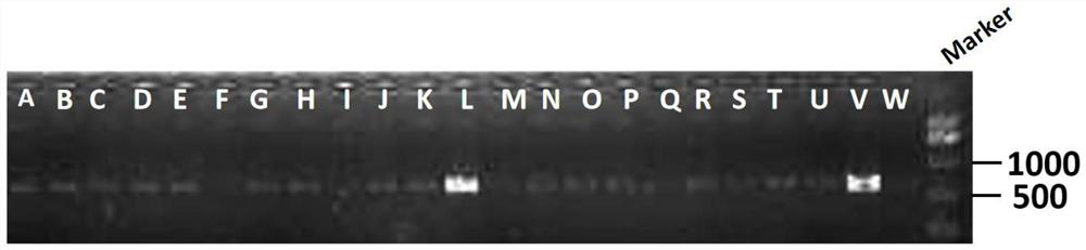 Application of ERK/mTOR signal path regulator to preparation of a drug for improving or treating neurodevelopmental disorder related diseases