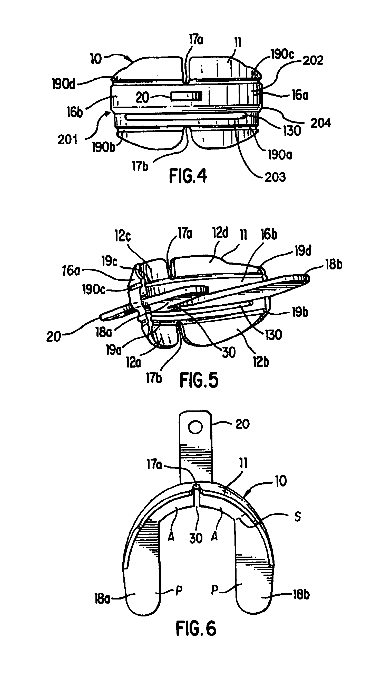 Mouthguard