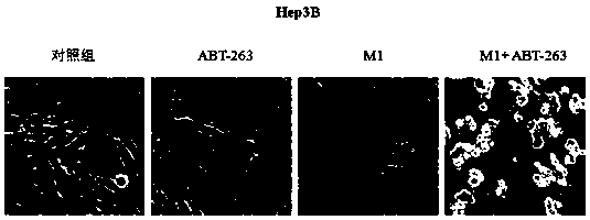 Application of bcl-xl inhibitor and oncolytic virus in the preparation of antitumor drugs