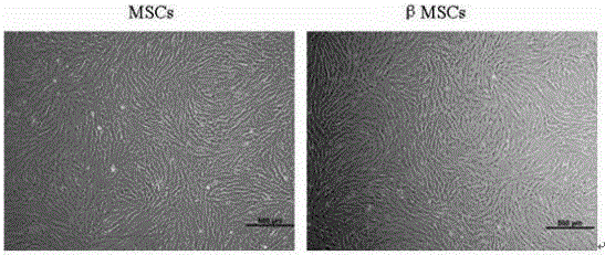 Exosome, preparing method of exosome and application of exosome in preparing medicine or preparation for treating sepsis