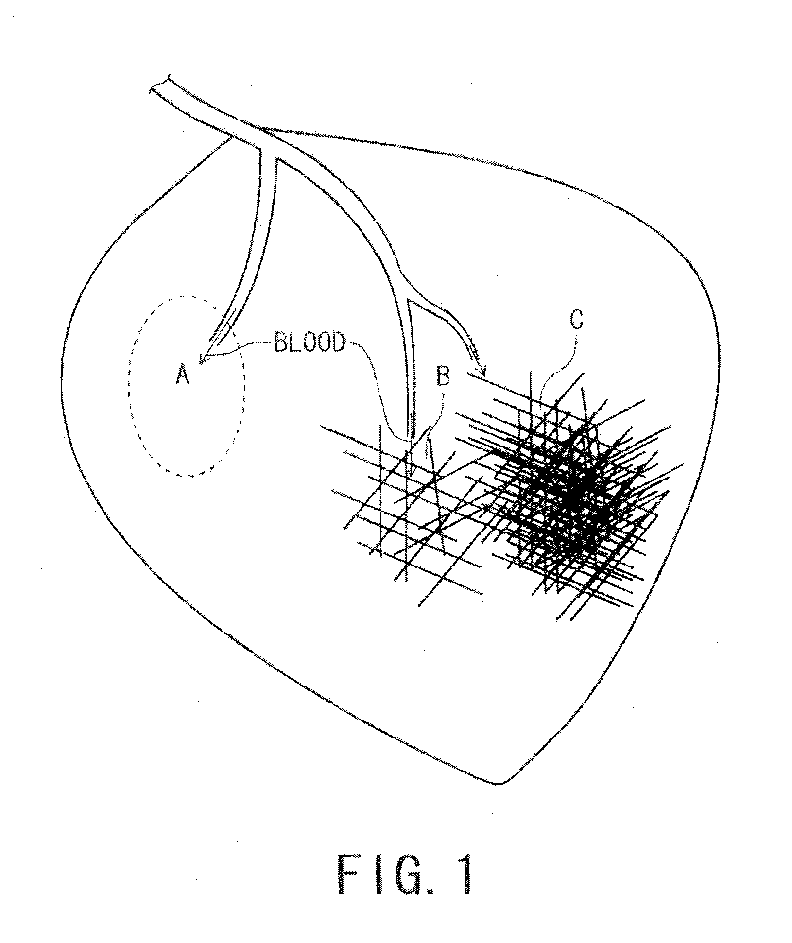 Magnetic resonance imaging apparatus and magnetic resonance imaging method