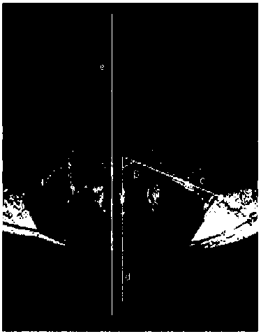 Novel three-axis adjusting type precise spine puncture positioning apparatus