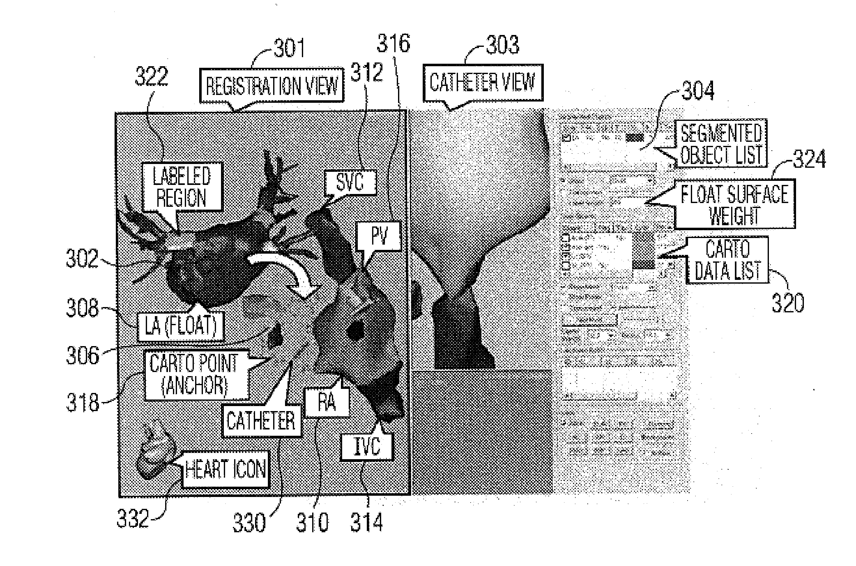 System and method for automatically registering three dimensional cardiac images with electro-anatomical cardiac mapping data