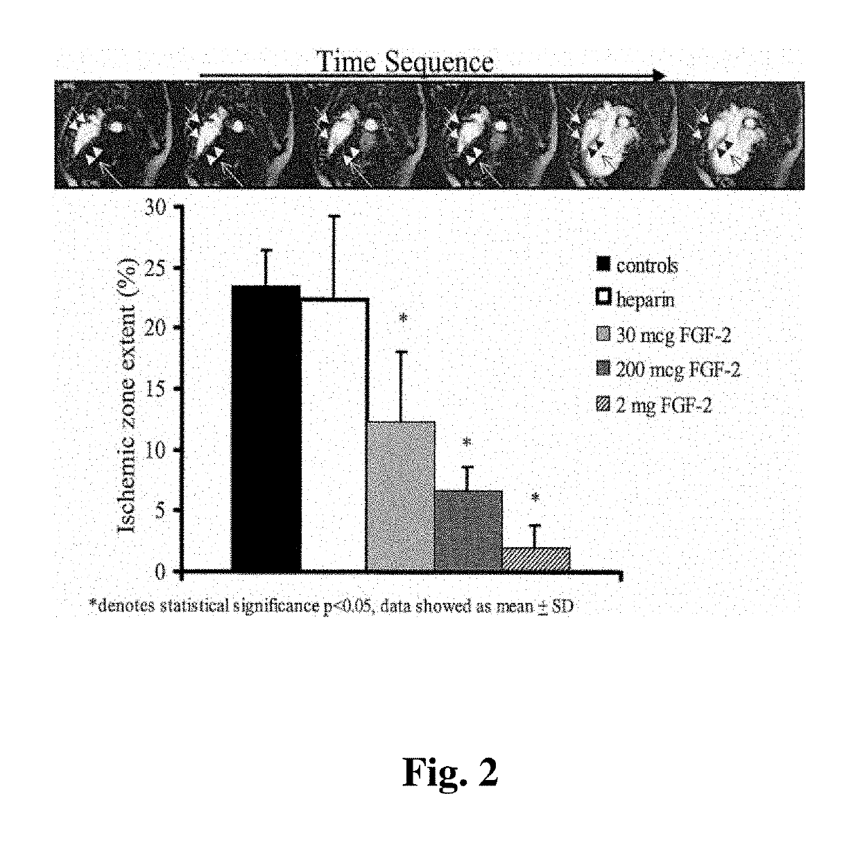 Combination growth factor therapy and cell therapy for treatment of acute and chronic diseases of the organs