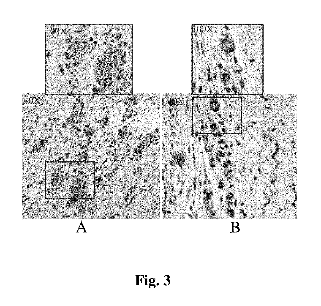 Combination growth factor therapy and cell therapy for treatment of acute and chronic diseases of the organs