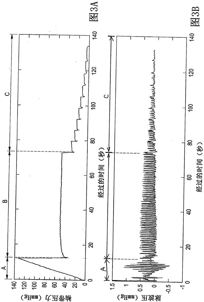 Blood pressure measuring apparatus and blood pressure measuring method