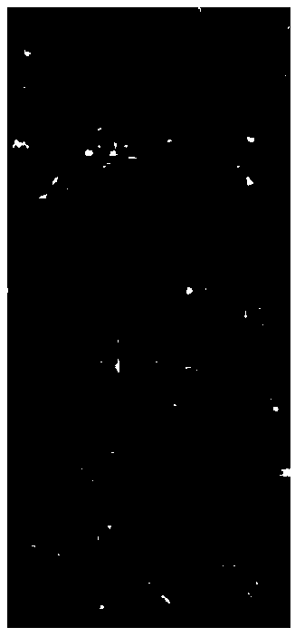 Method for preparing retinal pigment epithelial cell slice by using autologous immunocyte