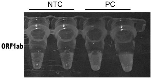 Novel coronavirus detection kit