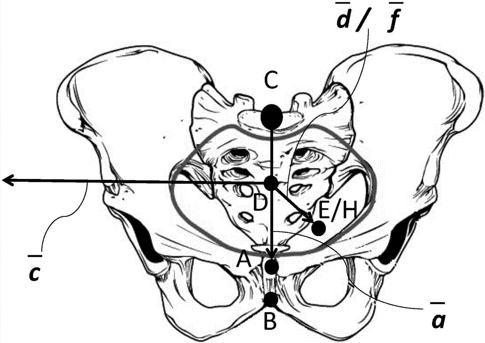 Method for fetal head orientation measurement based on electromagnetic positioning and ultrasonic imaging