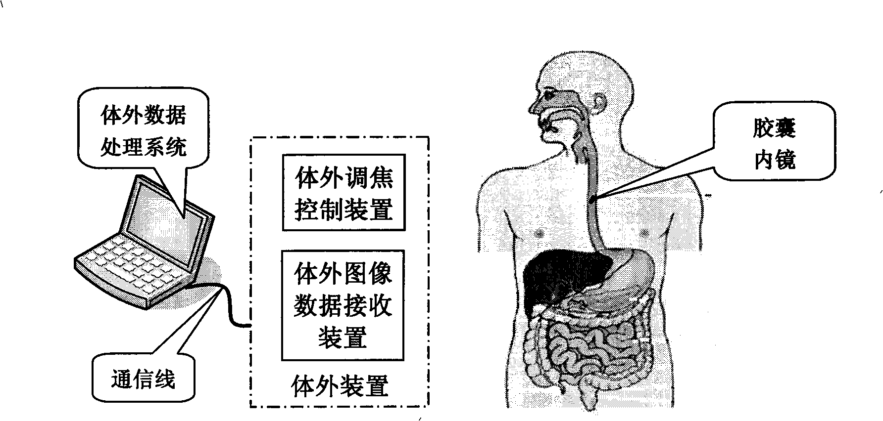 Capsule endoscopy automatic focusing system