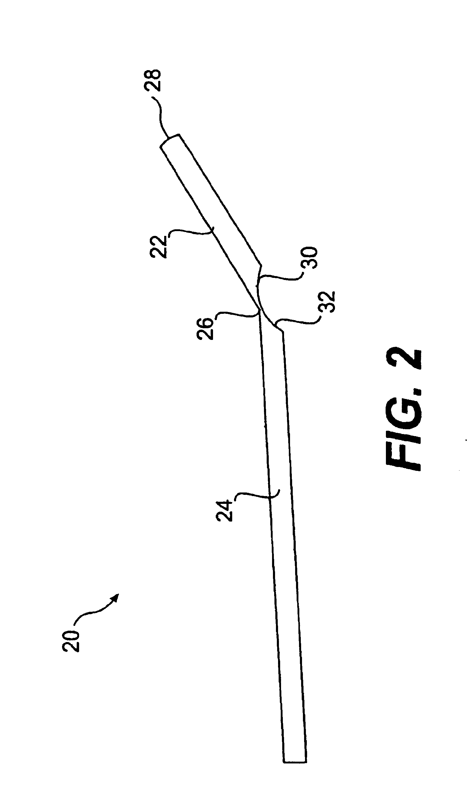 Methods and devices for delivering a ventricular stent