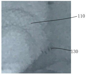 Blood vessel implant