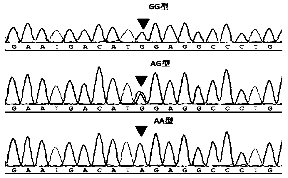 Detection method for cattle RET (Reticulocyte) gene single nucleotide polymorphism site and detection kit and application thereof