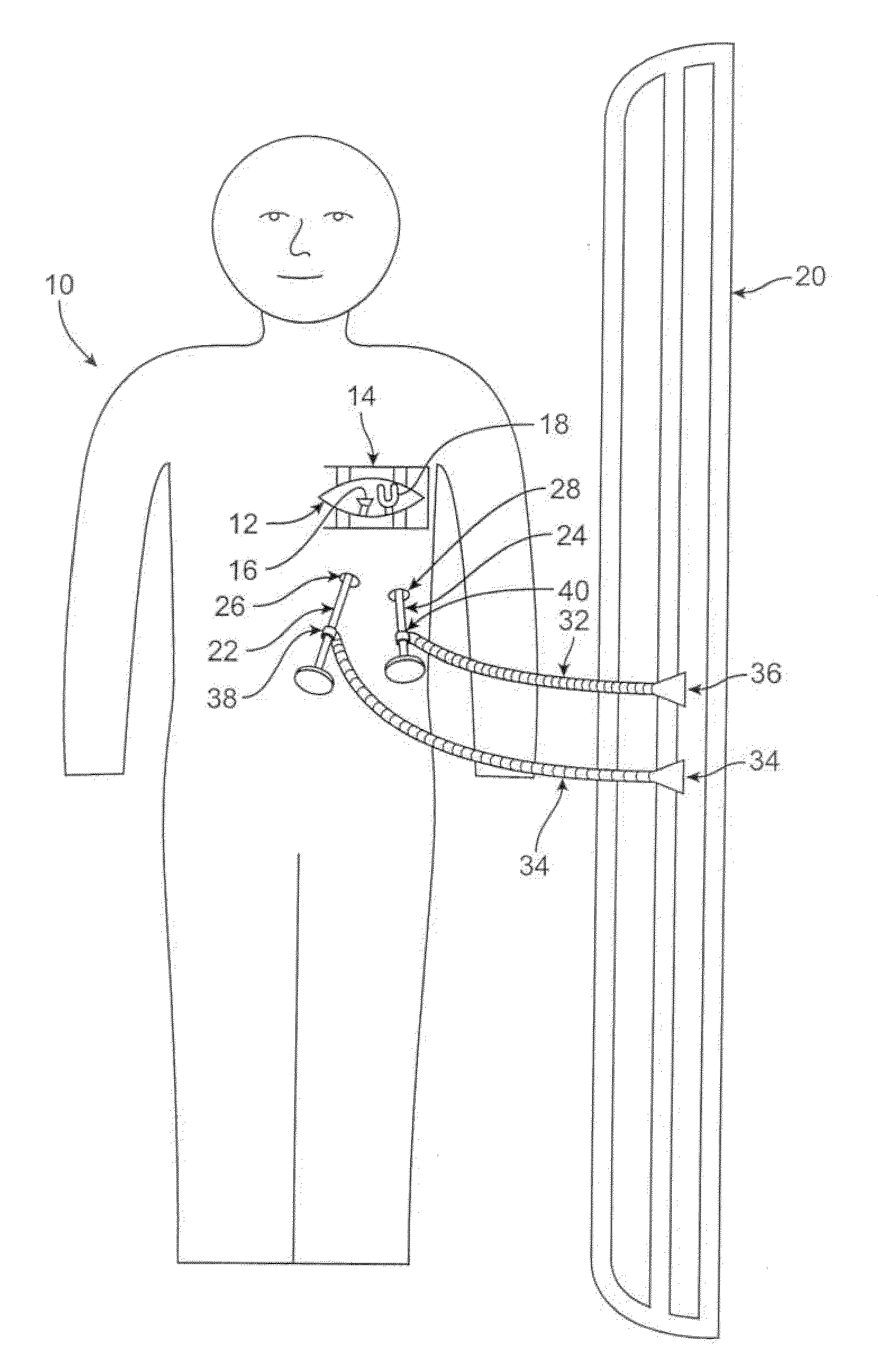 Methods and devices for cardiac surgery