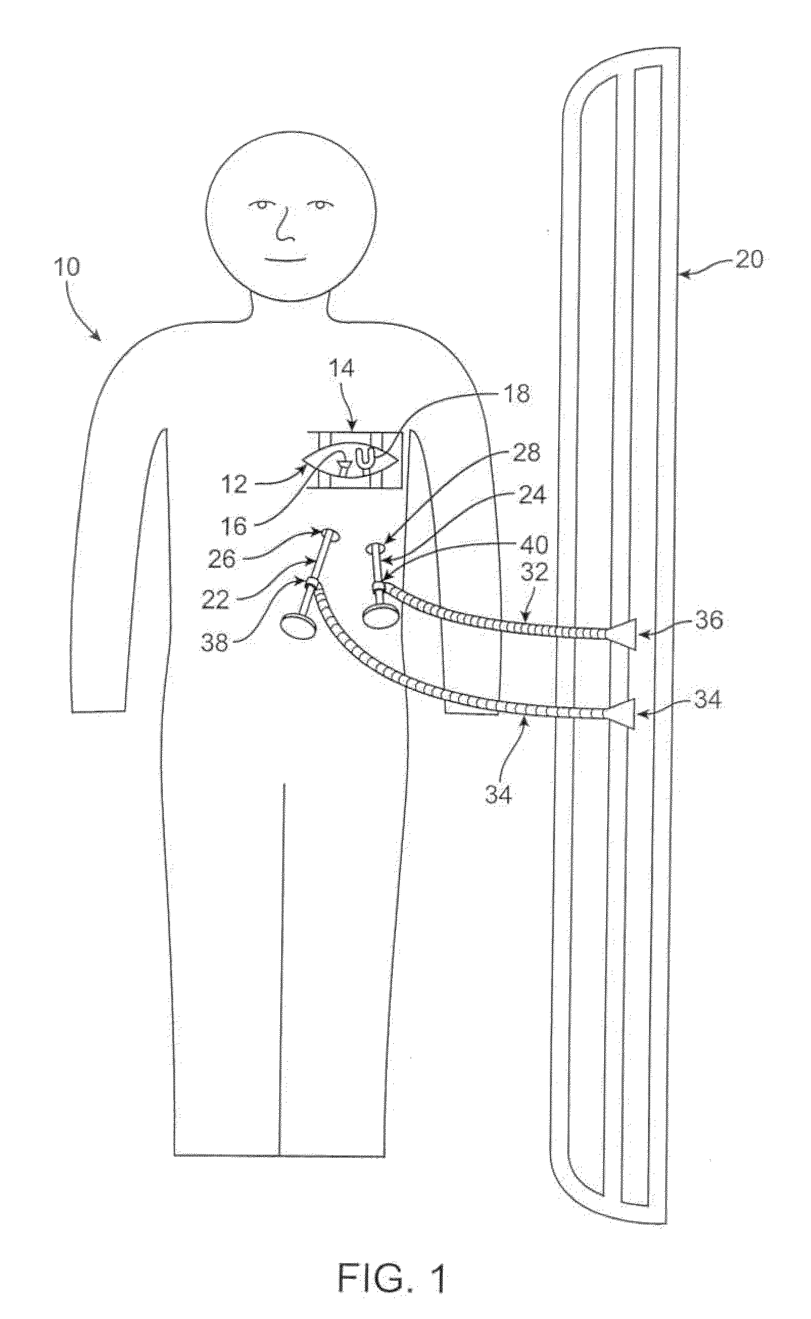 Methods and devices for cardiac surgery