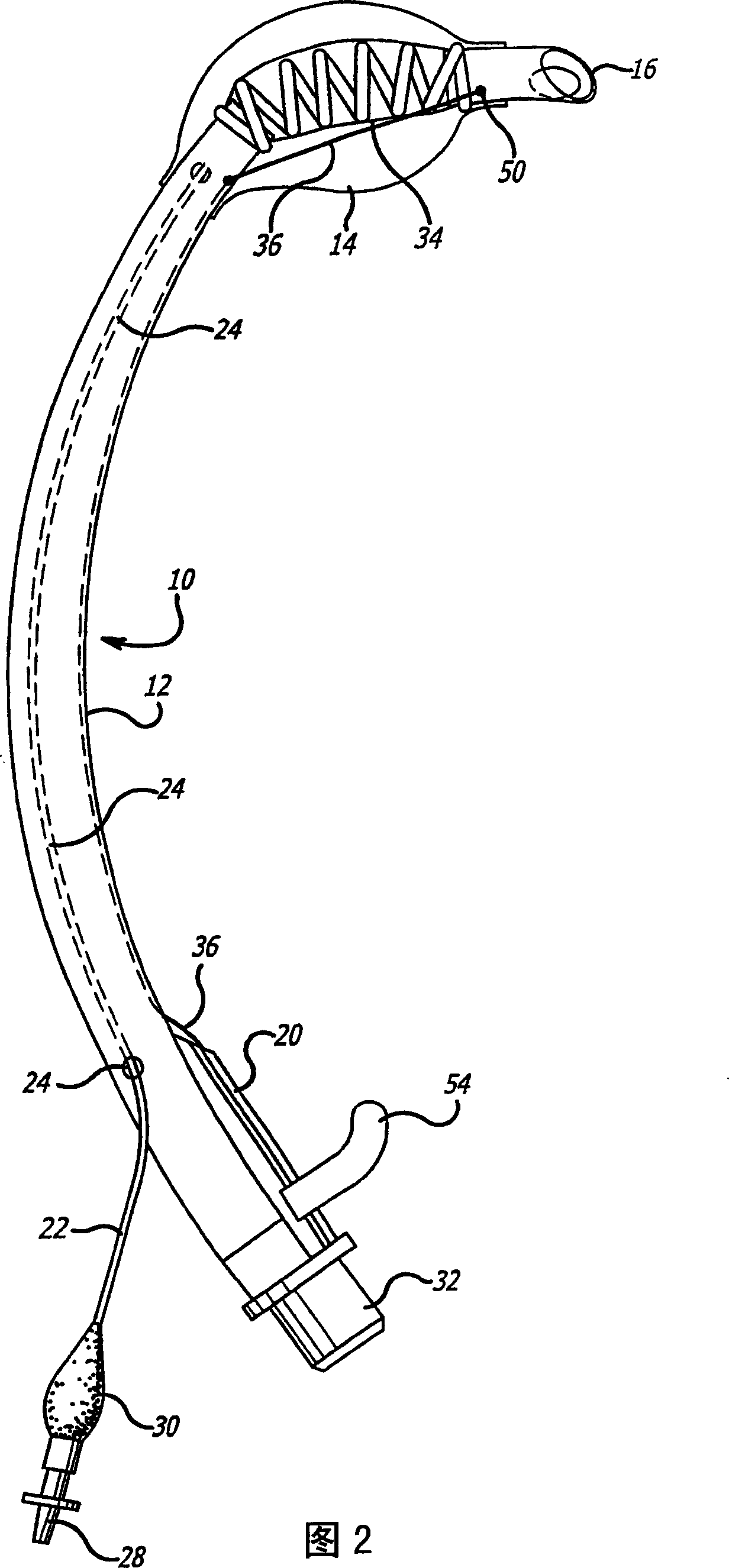 Endotracheal tube with tip directional control and position preserving mechanism