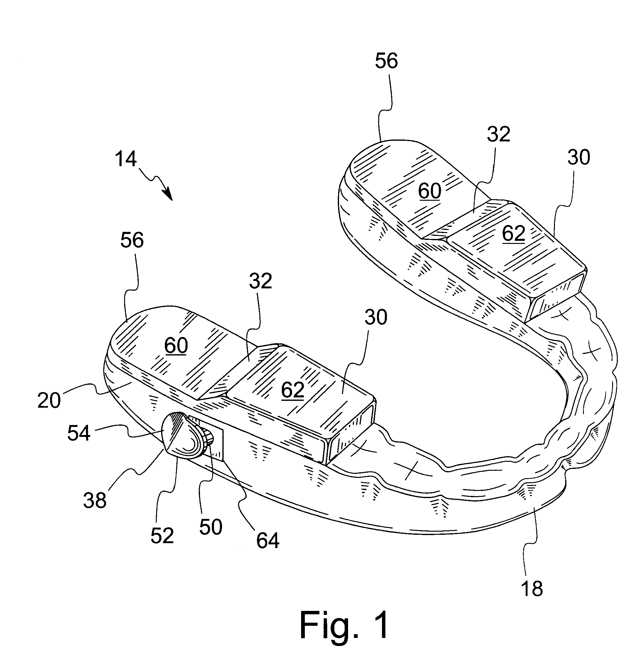 Anti-Retrusion Oral Appliance