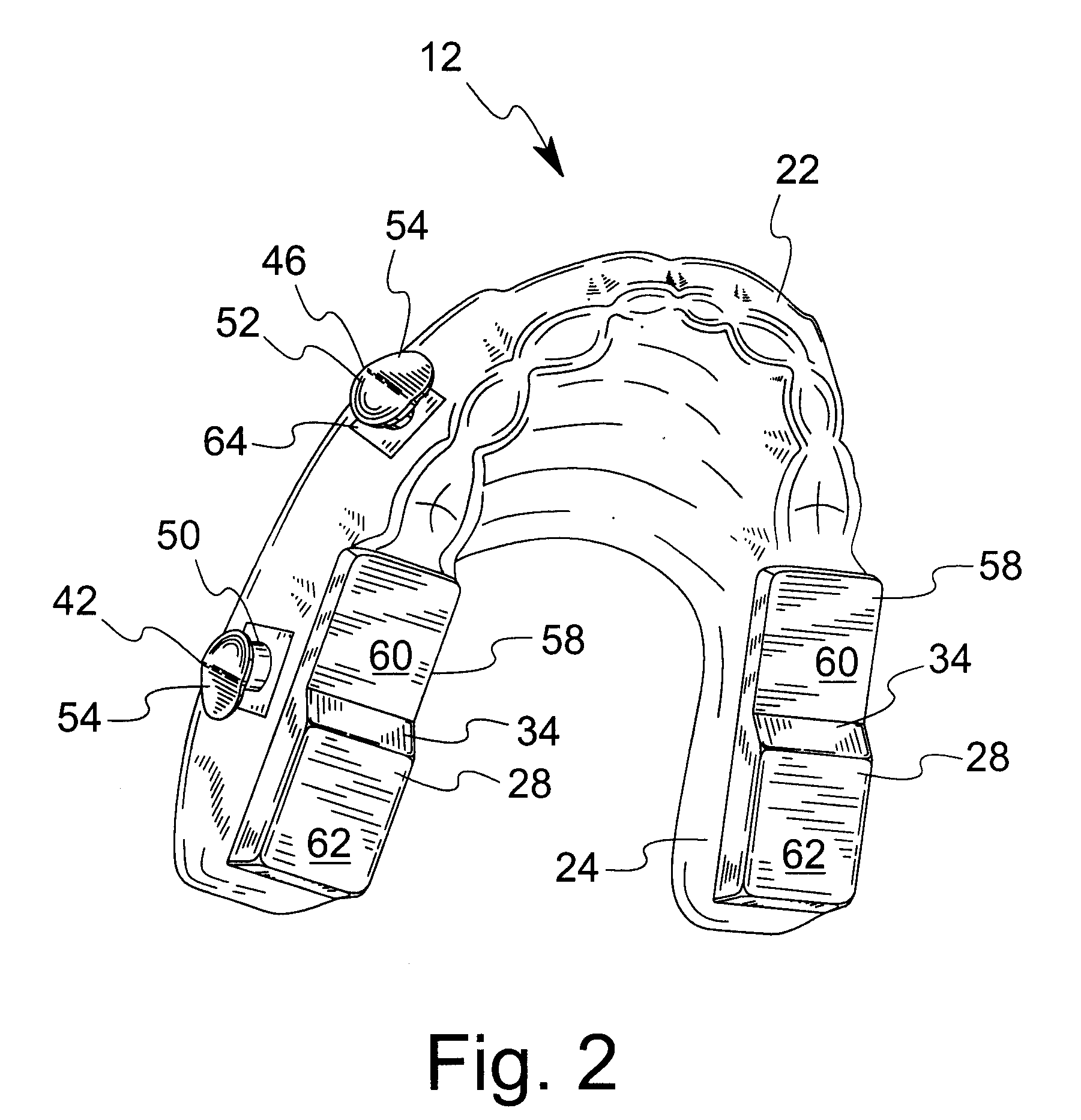 Anti-Retrusion Oral Appliance