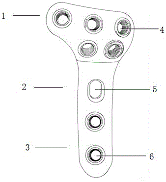 Degradable proximal tibia posterior-lateral locking internal fixation apparatus with development functions