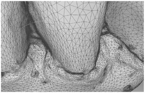 A Segmentation Method of 3D Teeth Mesh Data Based on Harmonic Field Algorithm