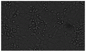 Anti-swine transmissible gastroenteritis virus and porcine epidemic diarrhea virus egg-yolk antibody and preparation method thereof